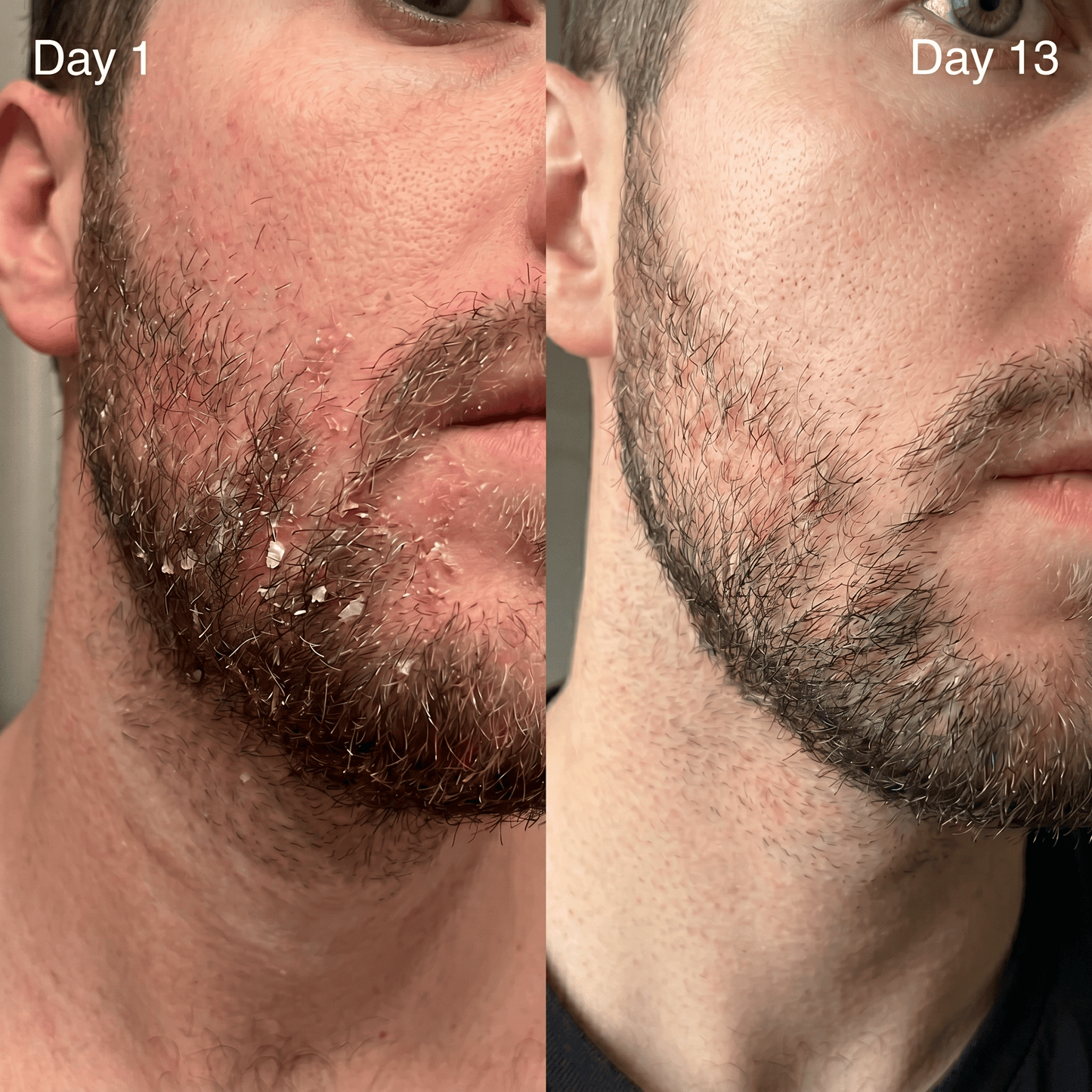Atrus Skin Renewal Cream
