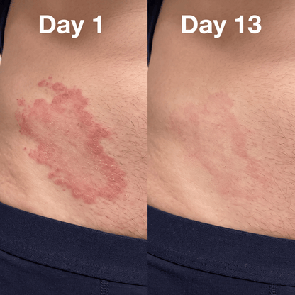 Atrus Skin Renewal Cream