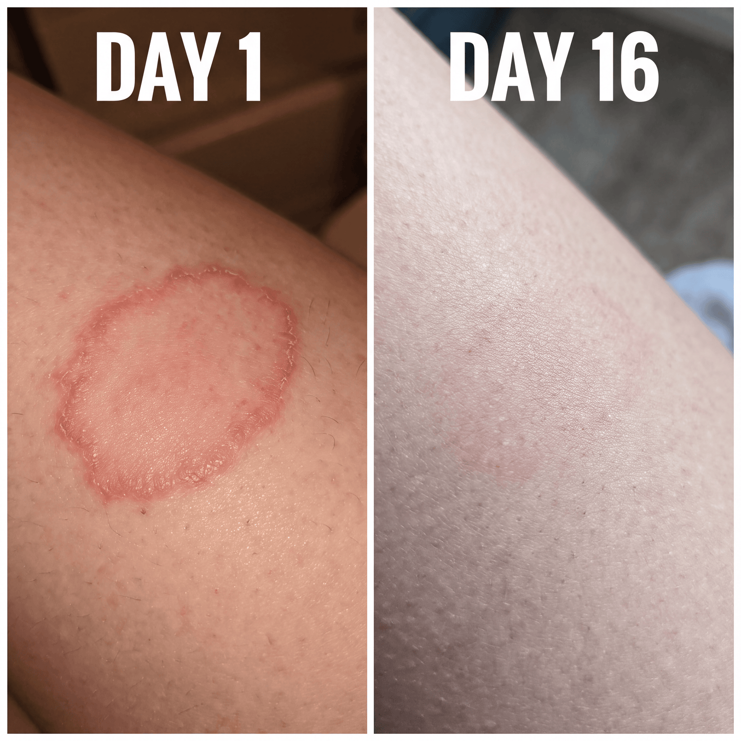 Atrus Skin Renewal Cream