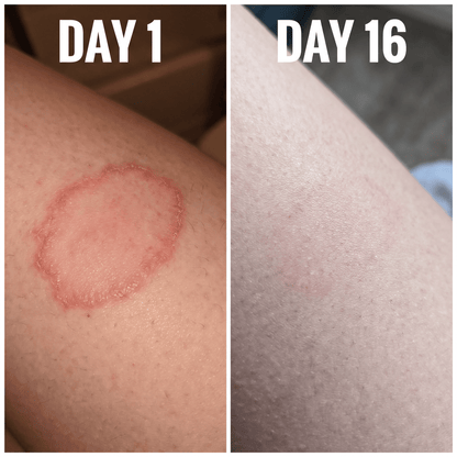 Atrus Skin Renewal Cream
